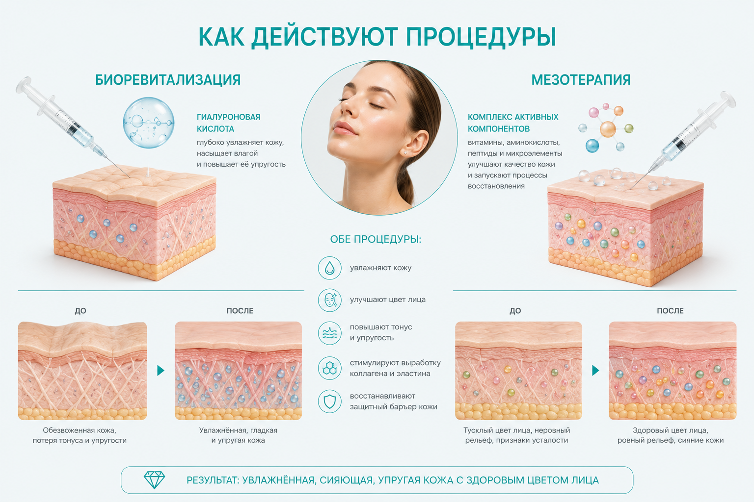 В чём разница между процедурами